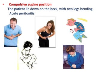 • Compulsive supine position
The patient lie down on the beck, with two legs bending.
Acute peritonitis
 