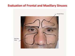 Evaluation of Frontal and Maxillary Sinuses
 