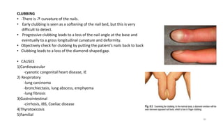 Nail Clubbing Algorithm PHYSICAL EXAMINATION.pptx