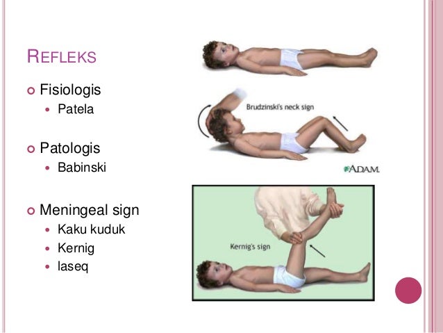 Physical examination akbid yrsj