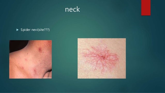 Hcv exame