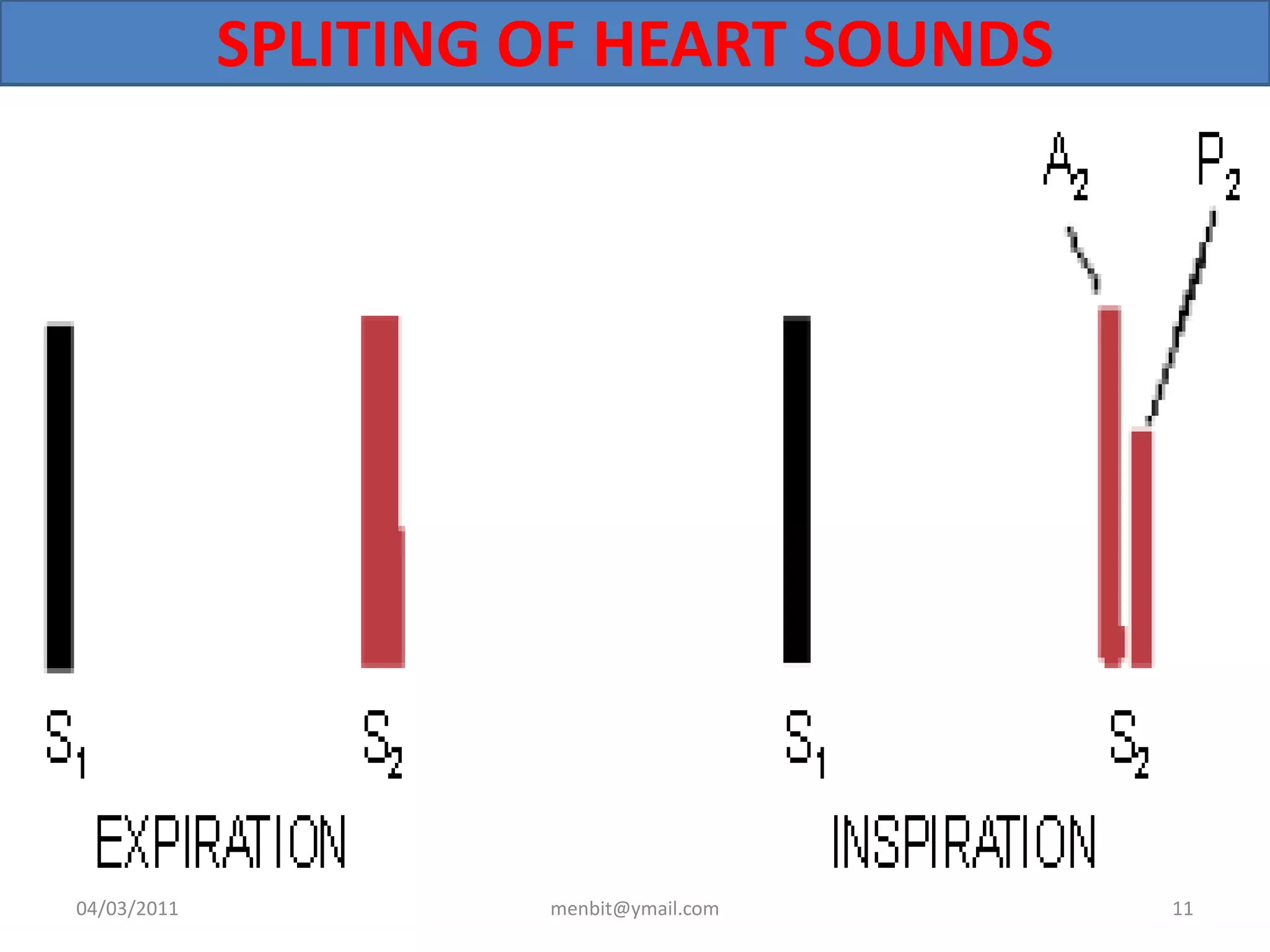 SPLITING OF HEART SOUNDS
04/03/2011 menbit@ymail.com 11
 