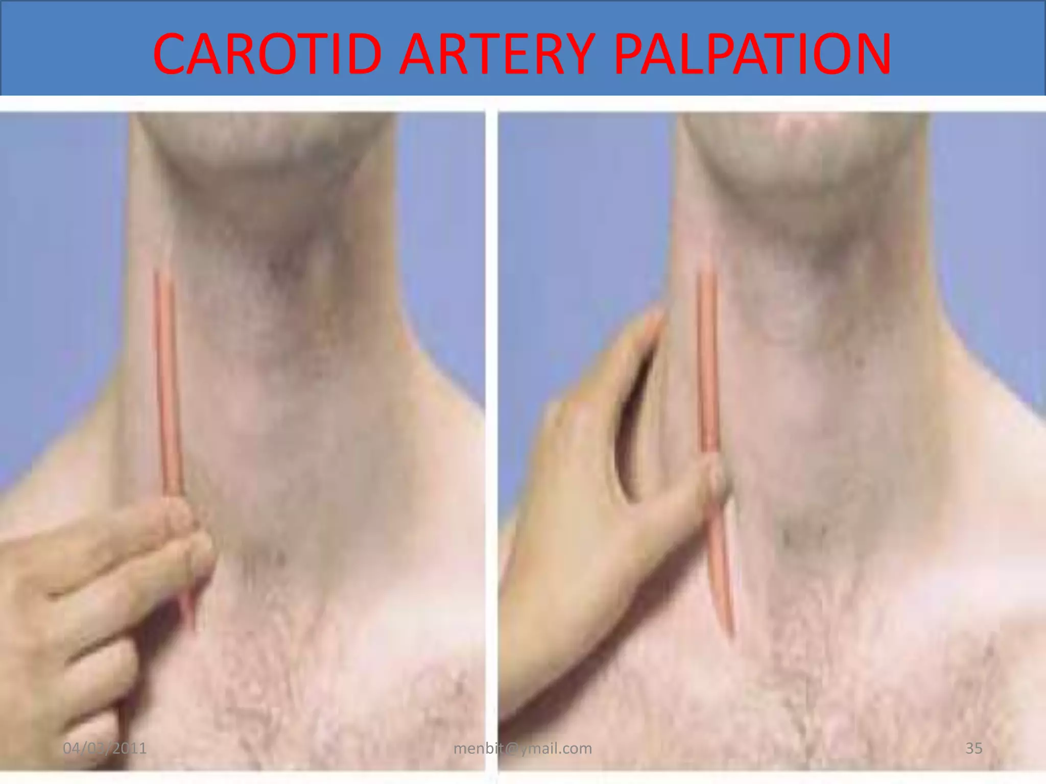 CAROTID ARTERY PALPATION
04/03/2011 menbit@ymail.com 35
 