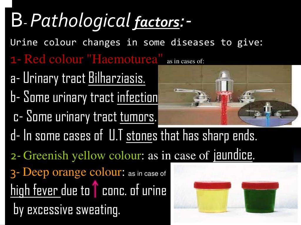 Physical examination of urine