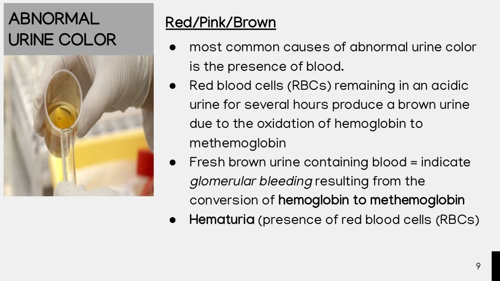 PHYSICAL EXAMINATION OF URINE.pdf