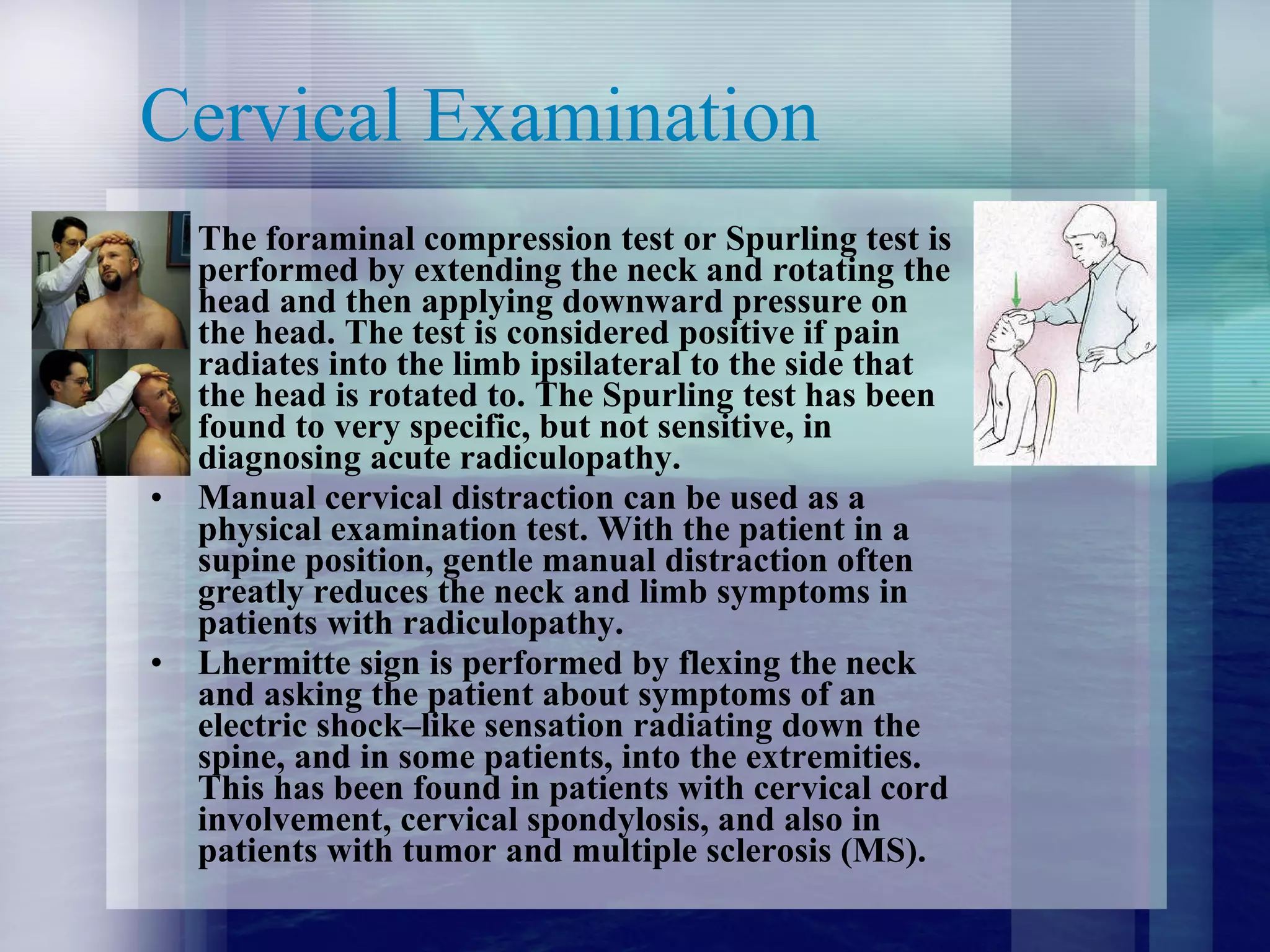 Cervical Examination The foraminal compression test or Spurling test is performed by extending the neck and rotating the head and then applying downward pressure on the head. The test is considered positive if pain radiates into the limb ipsilateral to the side that the head is rotated to. The Spurling test has been found to very specific, but not sensitive, in diagnosing acute radiculopathy.  Manual cervical distraction can be used as a physical examination test. With the patient in a supine position, gentle manual distraction often greatly reduces the neck and limb symptoms in patients with radiculopathy.  Lhermitte sign is performed by flexing the neck and asking the patient about symptoms of an electric shock–like sensation radiating down the spine, and in some patients, into the extremities. This has been found in patients with cervical cord involvement, cervical spondylosis, and also in patients with tumor and multiple sclerosis (MS).  