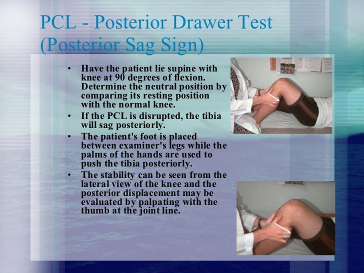 Physical examination signs