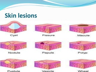 Skin lesions
 