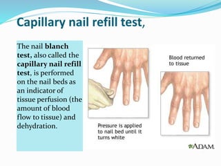 Capillary nail refill test,
The nail blanch
test, also called the
capillary nail refill
test, is performed
on the nail beds as
an indicator of
tissue perfusion (the
amount of blood
flow to tissue) and
dehydration.
 