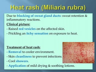 Physical hazards | PPTX
