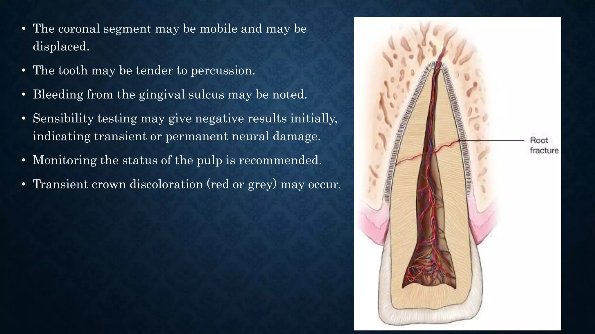 Physical injuries of teeth | PPTX