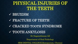 Dr Nagarathinam AE
Department of Oral Pathology
SRM DENTAL COLLEGE,Ramapuram, Chennai
PHYSICAL INJURIES OF
THE TEETH
 BRUXISM
 FRACTURE OF TEETH
 CRACKED TOOTH SYNDROME
 TOOTH ANKYLOSIS
 