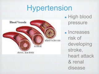 Hypertension
High blood
pressure
Increases
risk of
developing
stroke,
heart attack
& renal
disease
 