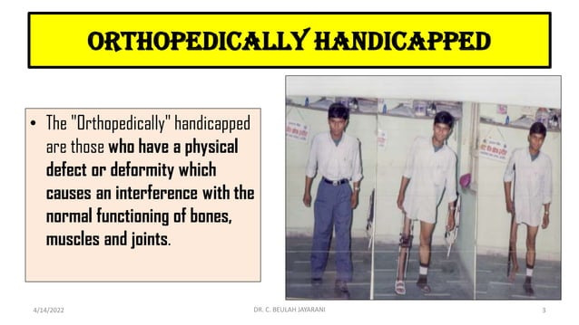 Physically challenged pdf