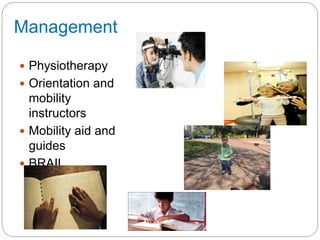 Management
 Physiotherapy
 Orientation and
mobility
instructors
 Mobility aid and
guides
 BRAIL
technology
 