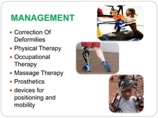 MANAGEMENT
 Correction Of
Deformities
 Physical Therapy
 Occupational
Therapy
 Massage Therapy
 Prosthetics
 devices for
positioning and
mobility
 
