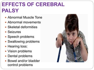 EFFECTS OF CEREBRAL
PALSY
 Abnormal Muscle Tone
 Abnormal movements
 Skeletal deformities
 Seizures
 Speech problems
 Swallowing problems
 Hearing loss:
 Vision problems
 Dental problems
 Bowel and/or bladder
control problems
 