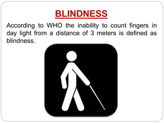 BLINDNESS
According to WHO the inability to count fingers in
day light from a distance of 3 meters is defined as
blindness.
 