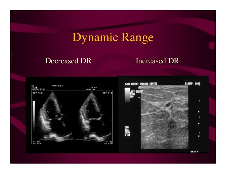 Physical Principles Of Ultrasound