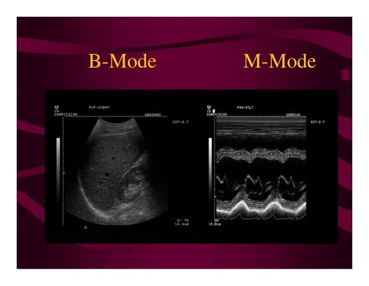 Physical Principles Of Ultrasound