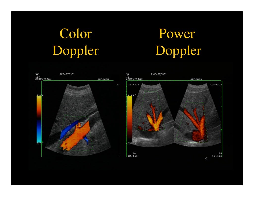 Physical Principles Of Ultrasound