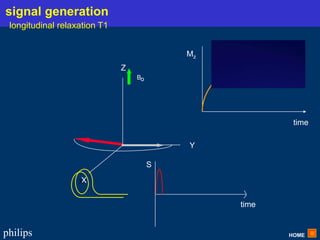HOME
philips
X
Y
Z
Bo
X
time
S
time
Mz
signal generation
longitudinal relaxation T1
 