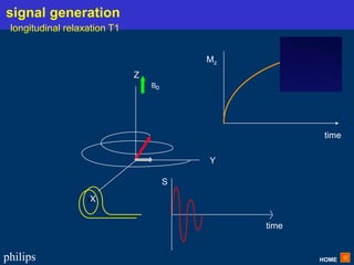 HOME
philips
X
Y
Z
Bo
X
time
time
Mz
S
signal generation
longitudinal relaxation T1
 