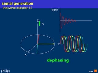 HOME
philips
X
Y
Z
Bo
Signal
dephasing
signal generation
transverse relaxation T2
 