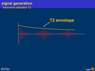 HOME
philips
T2 envelope
signal generation
transverse relaxation T2
 