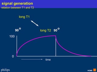 HOME
philips
long T1
long T2
0
time
100
90
o
90
o
signal generation
relation between T1 and T2
 