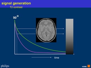 HOME
philips
time
90
o
signal generation
T2 contrast
 