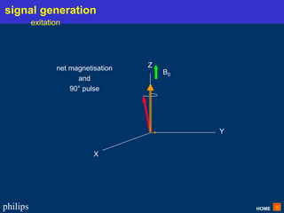 HOME
philips
net magnetisation
and
90° pulse
X
Y
Z
B0
Y
signal generation
exitation
 