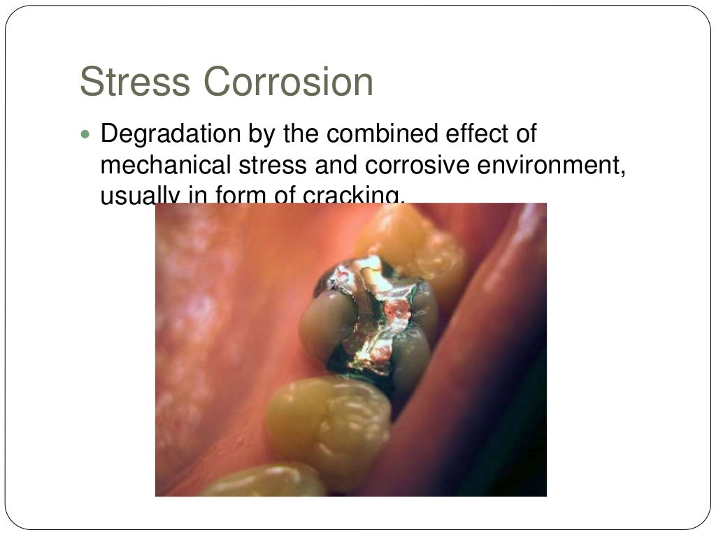Physical Properties of Dental Materials