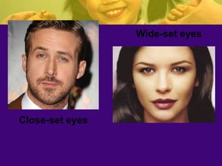 Close-set eyes
Wide-set eyes
 