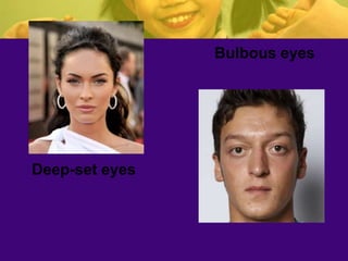 Deep-set eyes
Bulbous eyes
 