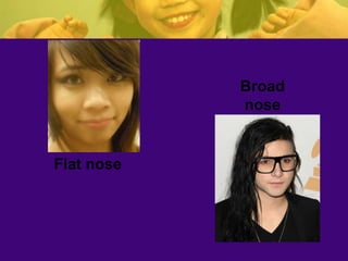 Flat nose
Broad
nose
 