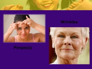 Pimple(s)
Wrinkles
 