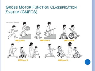 Physical Therapy in Cerebral Palsy.pptx