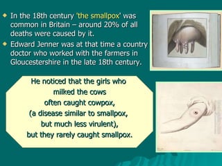 In the 18th century  'the smallpox ' was common in Britain – around 20% of all deaths were caused by it.  Edward Jenner was at that time a country doctor who worked with the farmers in Gloucestershire in the late 18th century.  He noticed that the girls who  milked the cows often caught cowpox,  (a disease similar to smallpox,  but much less virulent), but they rarely caught smallpox.  