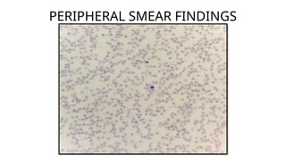 physicon - hereditary spherocytosis.pptx