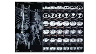 physicon ivc 1.pptx