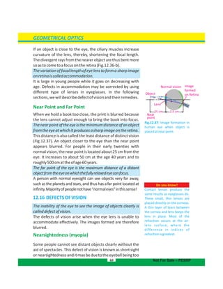 GEOMETRICAL OPTICS
60 Not For Sale – PESRP
Fig.12.37: Image formation in
human eye when object is
placedatnearpoint.
Normal vision
Object
25 cm 2.5 cm
Near
point
Lens
Image
formed
on Retina
Do you know?
Contact lenses produce the
same results as eyeglasses do.
These small, thin lenses are
placed directly on the corneas.
A thin layer of tears between
the cornea and lens keeps the
lens in place. Most of the
refraction occurs at the air-
lens surface, where the
difference in indices of
refractionisgreatest.
If an object is close to the eye, the ciliary muscles increase
curvature of the lens, thereby, shortening the focal length.
The divergent rays from the nearer object are thus bent more
soastocometoafocusontheretina(Fig.12.36-b).
The variationof focallengthof eye lensto form a sharp image
onretinaiscalledaccommodation.
It is large in young people while it goes on decreasing with
age. Defects in accommodation may be corrected by using
different type of lenses in eyeglasses. In the following
sections,wewilldescribedefectofvisionandtheirremedies.
Near Point and Far Point
When we hold a book too close, the print is blurred because
the lens cannot adjust enough to bring the book into focus.
Thenearpointoftheeyeistheminimumdistanceofanobject
fromtheeyeatwhichitproducesasharpimageontheretina.
This distance is also called the least distance of distinct vision
(Fig.12.37). An object closer to the eye than the near point
appears blurred. For people in their early twenties with
normal vision, the near point is located about 25 cm from the
eye. It increases to about 50 cm at the age 40 years and to
roughly500cmattheofage60years.
The far point of the eye is the maximum distance of a distant
objectfromtheeyeonwhichthefullyrelaxedeyecanfocus.
A person with normal eyesight can see objects very far away,
such as the planets and stars, and thus has a far point located at
infinity.Majorityofpeoplenothave“normaleyes”inthissense!
12.16 DEFECTSOFVISION
The inability of the eye to see the image of objects clearly is
calleddefectofvision.
The defects of vision arise when the eye lens is unable to
accommodate effectively. The images formed are therefore
blurred.
Nearsightedness (myopia)
Some people cannot see distant objects clearly without the
aid of spectacles. This defect of vision is known as short sight
ornearsightednessanditmaybeduetotheeyeballbeingtoo
 