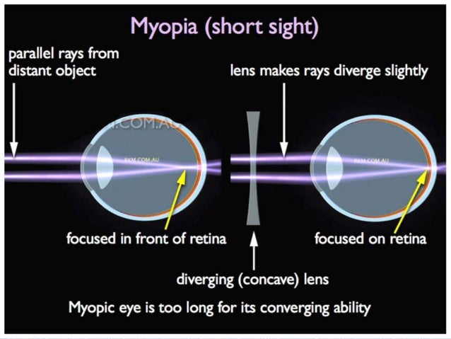 Physics ( human eye and the colourful world).