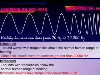 Sound - Physics