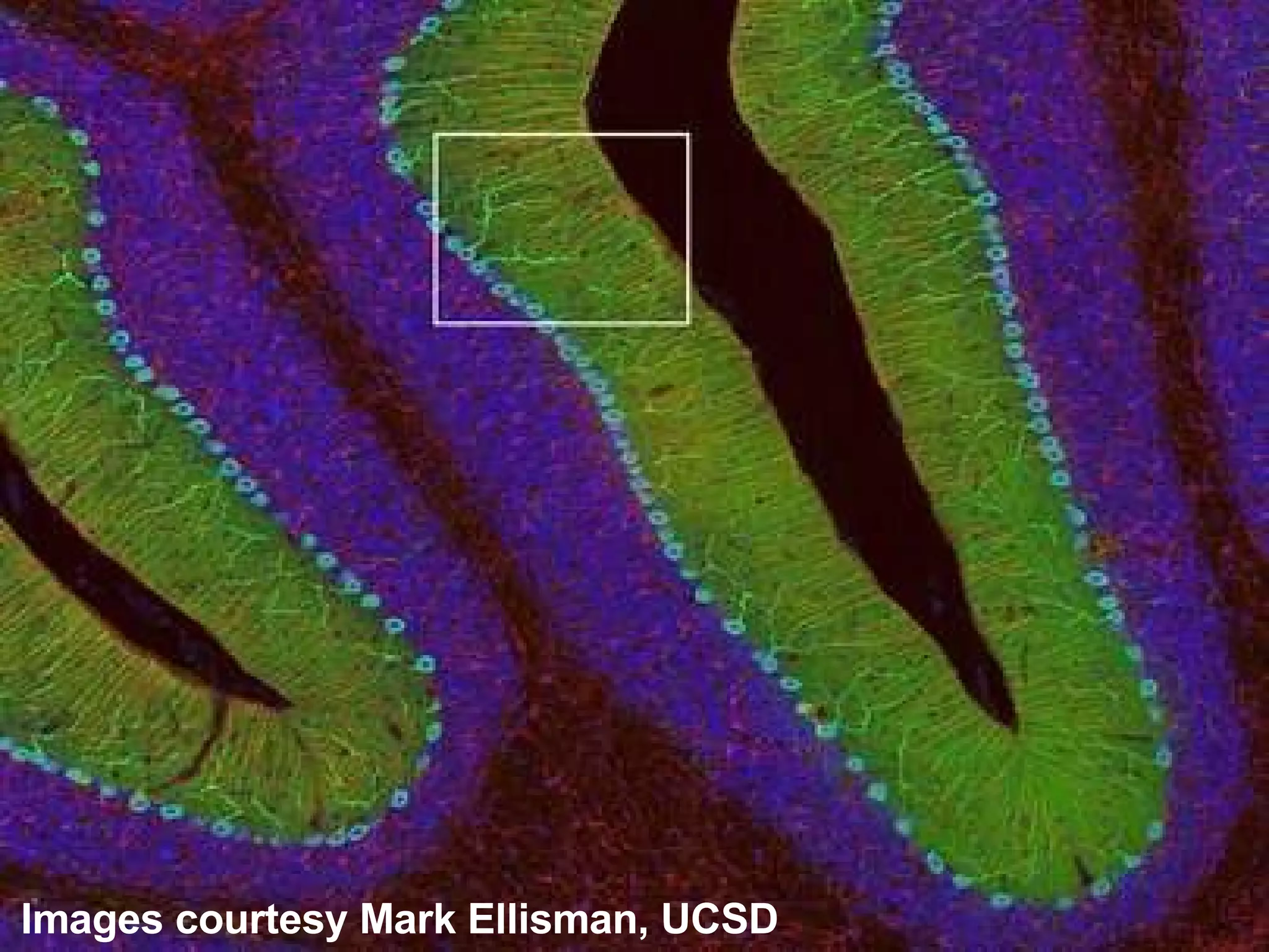Images courtesy Mark Ellisman, UCSD 