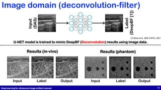 Image domain (deconvolution-filter)
Input
(DAS)
Label
(DeepBF
[1])
U-NET model is trained to mimic DeepBF (Deconvolution) results using image data.
Results (in-vivo) Results (phantom)
Input Label Output Input Label Output
Deep learning for ultrasound image artifact removal 11
[1] Khan et al, IEEE TUFFC, 2021
 