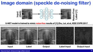 Image domain (speckle de-noising filter)
Input
(DAS)
Noise-Free
Label
[1]
U-NET model is trained to mimic noise-free results of [1] Zhu, Lei, et al, IEEE CVPR 2017
Input Label Output Label-Input Output-Input
Deep learning for ultrasound image artifact removal 12
 