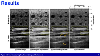 Axial
depth(mm)
36
27
18
9
0
45
Phantom
in
vivo
Lateral length(mm)
0 20
10 30 38.2
(a) Input image (b) histogram equalization (c) standard CycleGAN (d) our method
A B
C
Physics-informed deep learning for ultrasound image artifact removal 24
Results
 
