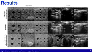 Proposed
Alpinion
ECUBE
12R
High
quality
images
NPUS050
low-quality
images
phantom in vivo
Physics-informed deep learning for ultrasound image artifact removal 25
Results
 