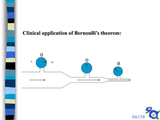 0
0
0
+
-
Clinical application of Bernoulli’s theorem:
56/78
 